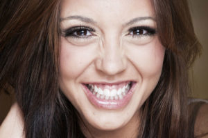 gummy-smile-bunny-lines
