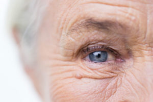 mole-aging-skin-dry-skin