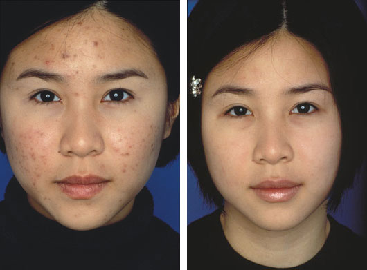 obagi skin treatment